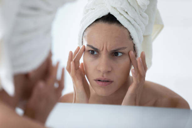 Wrinkles on the Forehead: How to Treat and Prevent Them