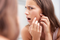 Skin Picking Disorder: Why Expressing Pimples Can Be Addictive